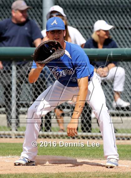 Thumbnail 2 in Analy vs. Acalanes (CIF NCS D3 Final) photogallery.