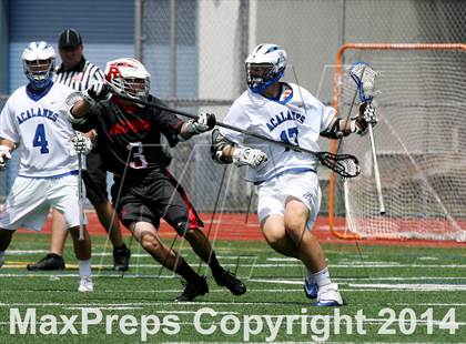 Thumbnail 3 in Redwood @ Acalanes photogallery.