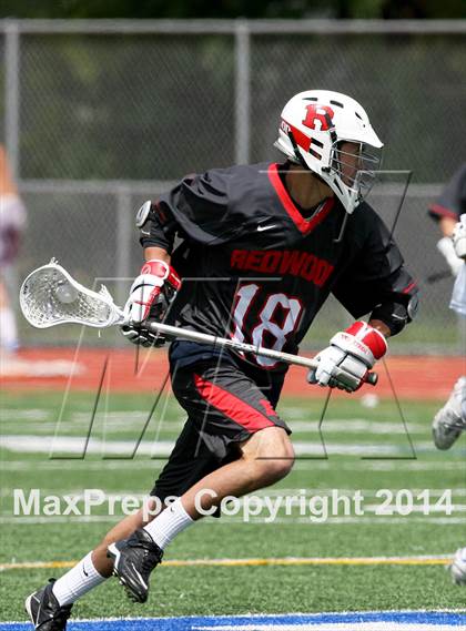 Thumbnail 1 in Redwood @ Acalanes photogallery.