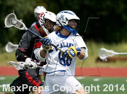 Thumbnail 2 in Redwood @ Acalanes photogallery.