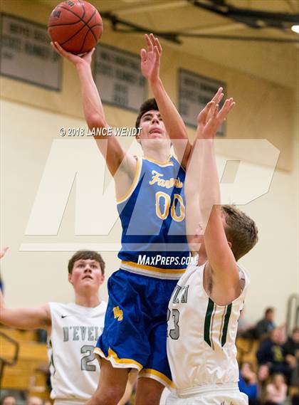 Thumbnail 2 in Wheat Ridge v D'Evelyn photogallery.