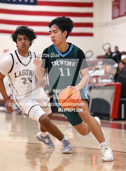 Thumbnail 1 in Irvine vs. Laguna Beach (Coast Classic) photogallery.