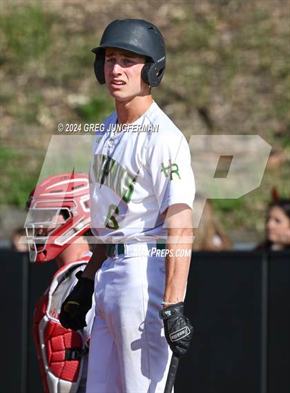Thumbnail 3 in University @ Head-Royce (CIF NCS D5 Semi-Final) photogallery.