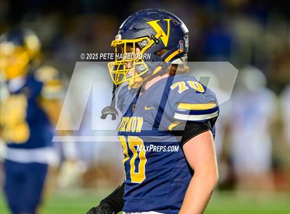 Thumbnail 2 in Warren Hills Regional @ Vernon photogallery.