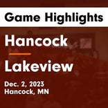 Hancock vs. Becker