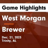 Brewer's loss ends three-game winning streak at home
