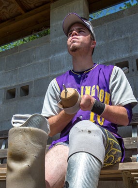 Josh Ruchotzke has prosthetics on both legs.