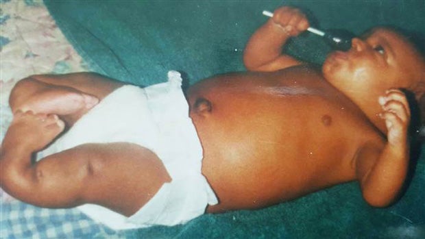 Hodges' legs were damaged at birth and two years later, both his legs were amputated below the knee.