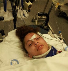 Kalabrya Gondrezick and her mother survived a head-on traffic accident, andthe incident has become a teachingpoint for the coaching staff.