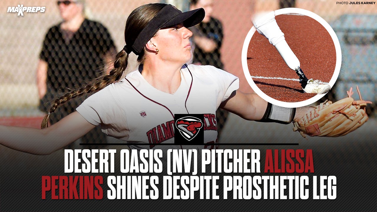 SOFTBALL: Prosthetic doesn’t stop NV star