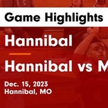 Hannibal vs. Fulton