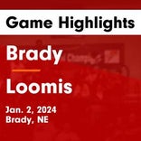 Loomis vs. Brady