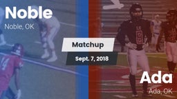 Matchup: Noble  vs. Ada  2018