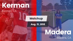 Matchup: Kerman  vs. Madera  2018