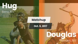 Matchup: Hug  vs. Douglas  2017