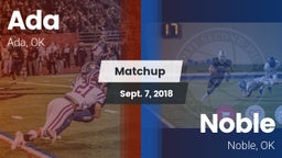 Matchup: Ada  vs. Noble  2018