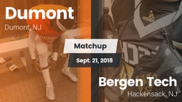 Matchup: Dumont  vs. Bergen Tech  2018