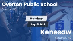 Matchup: Overton Public vs. Kenesaw  2018