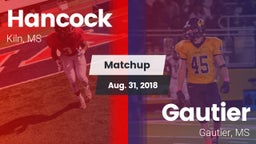 Matchup: Hancock vs. Gautier  2018