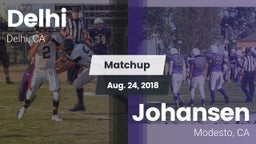 Matchup: Delhi vs. Johansen  2018