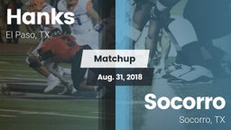 Matchup: Hanks vs. Socorro  2018
