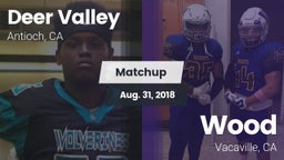 Matchup: Deer Valley vs. Wood  2018