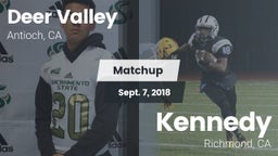Matchup: Deer Valley vs. Kennedy  2018