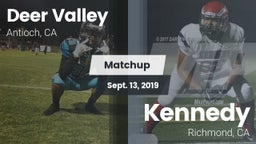 Matchup: Deer Valley vs. Kennedy  2019