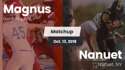 Matchup: Magnus vs. Nanuet  2018