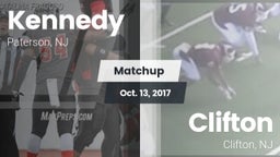 Matchup: Kennedy vs. Clifton  2017