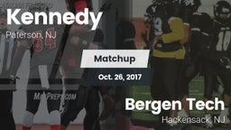 Matchup: Kennedy vs. Bergen Tech  2017