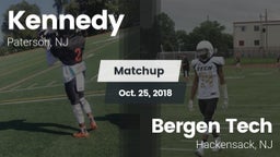 Matchup: Kennedy vs. Bergen Tech  2018