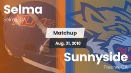 Matchup: Selma vs. Sunnyside  2018
