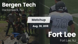 Matchup: Bergen Tech vs. Fort Lee  2018