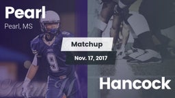 Matchup: Pearl  vs. Hancock 2017