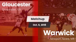 Matchup: Gloucester vs. Warwick  2018