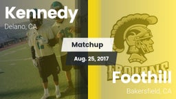 Matchup: Kennedy vs. Foothill  2017