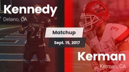 Matchup: Kennedy vs. Kerman  2017