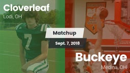 Matchup: Cloverleaf vs. Buckeye  2018
