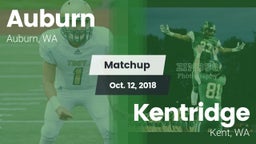 Matchup: Auburn  vs. Kentridge  2018