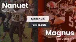 Matchup: Nanuet  vs. Magnus  2018