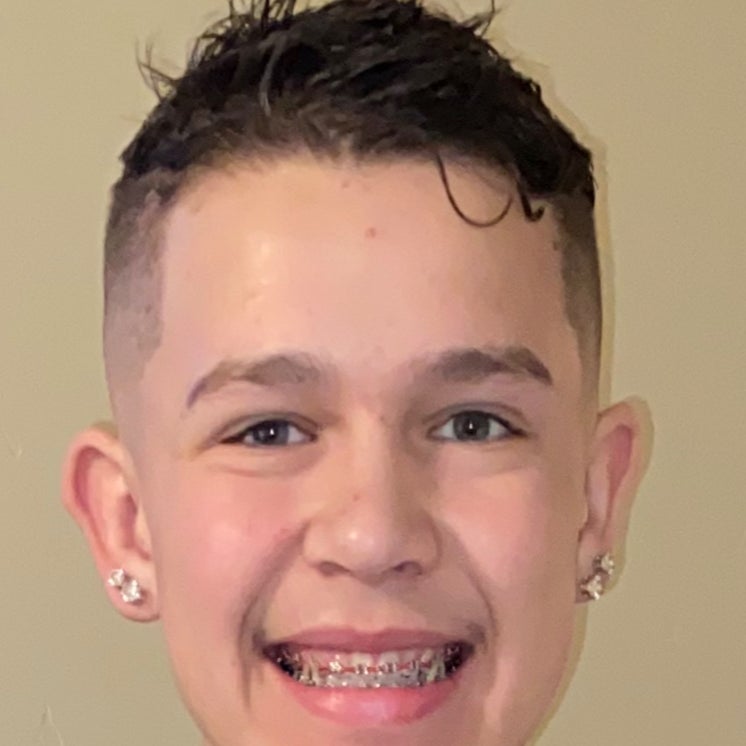 24