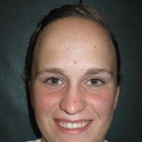 Amanda Whipple