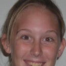 Kirsten Elser mugshot