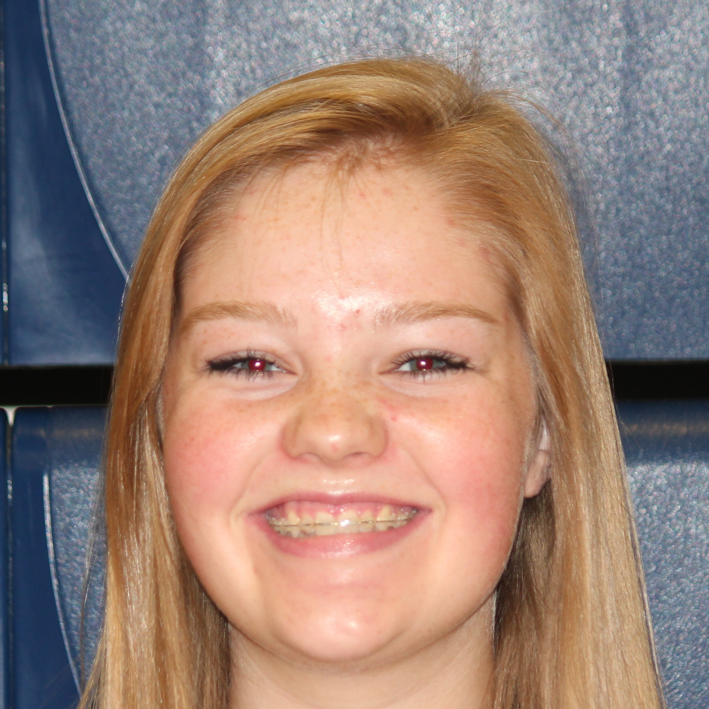 Hannah Beckstrand