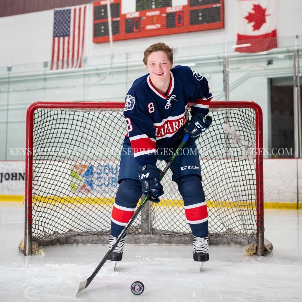 Trevor Severson