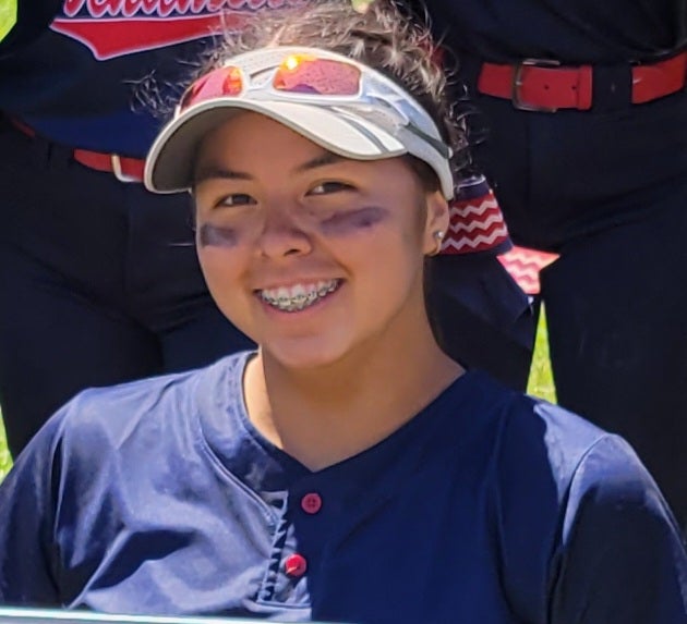 O. Perez