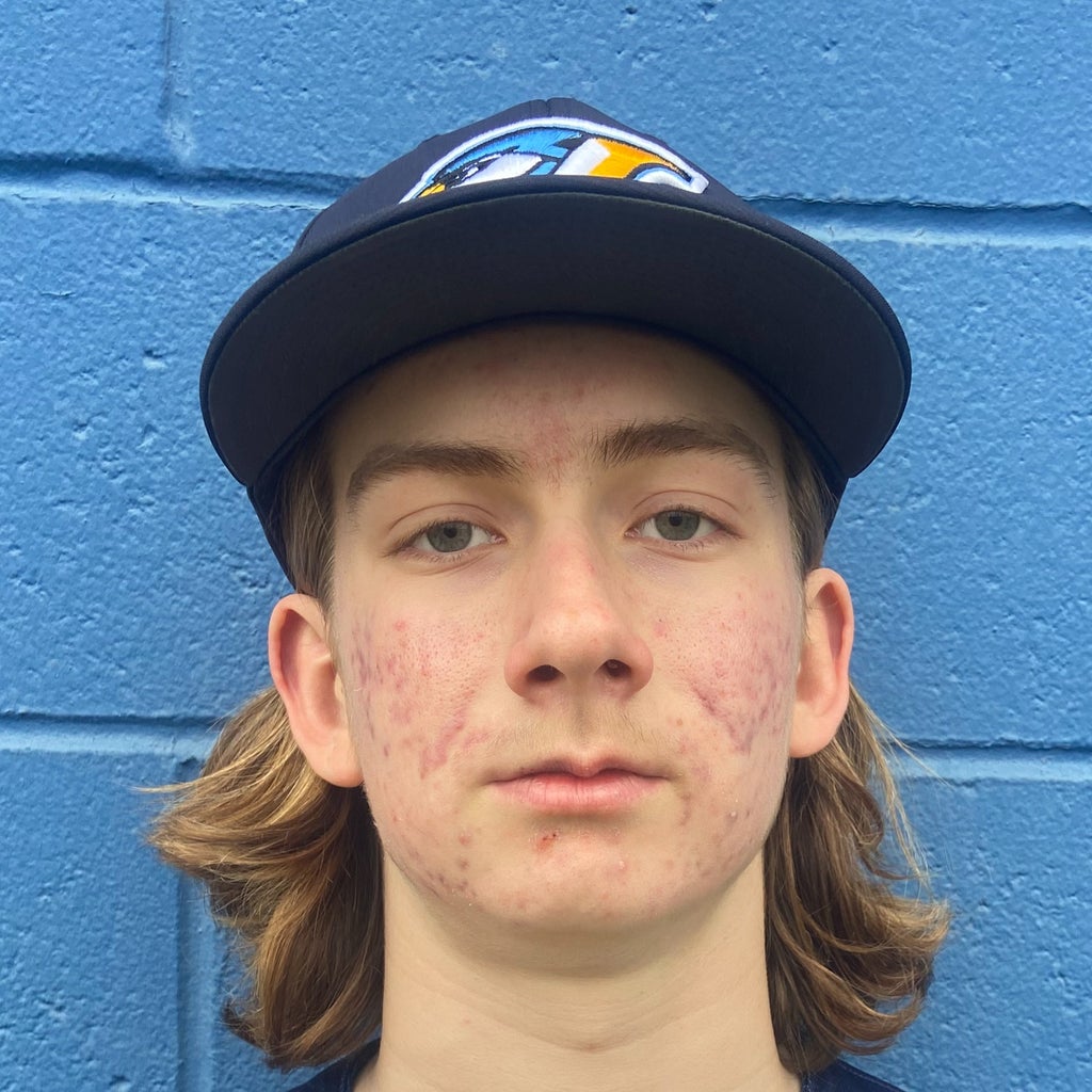 Luke Metzner mugshot