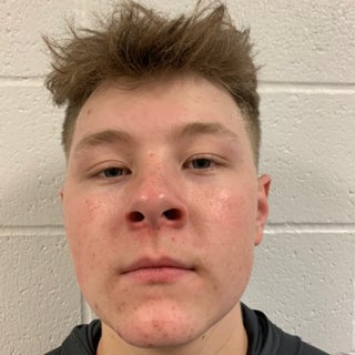 Dean Furer mugshot