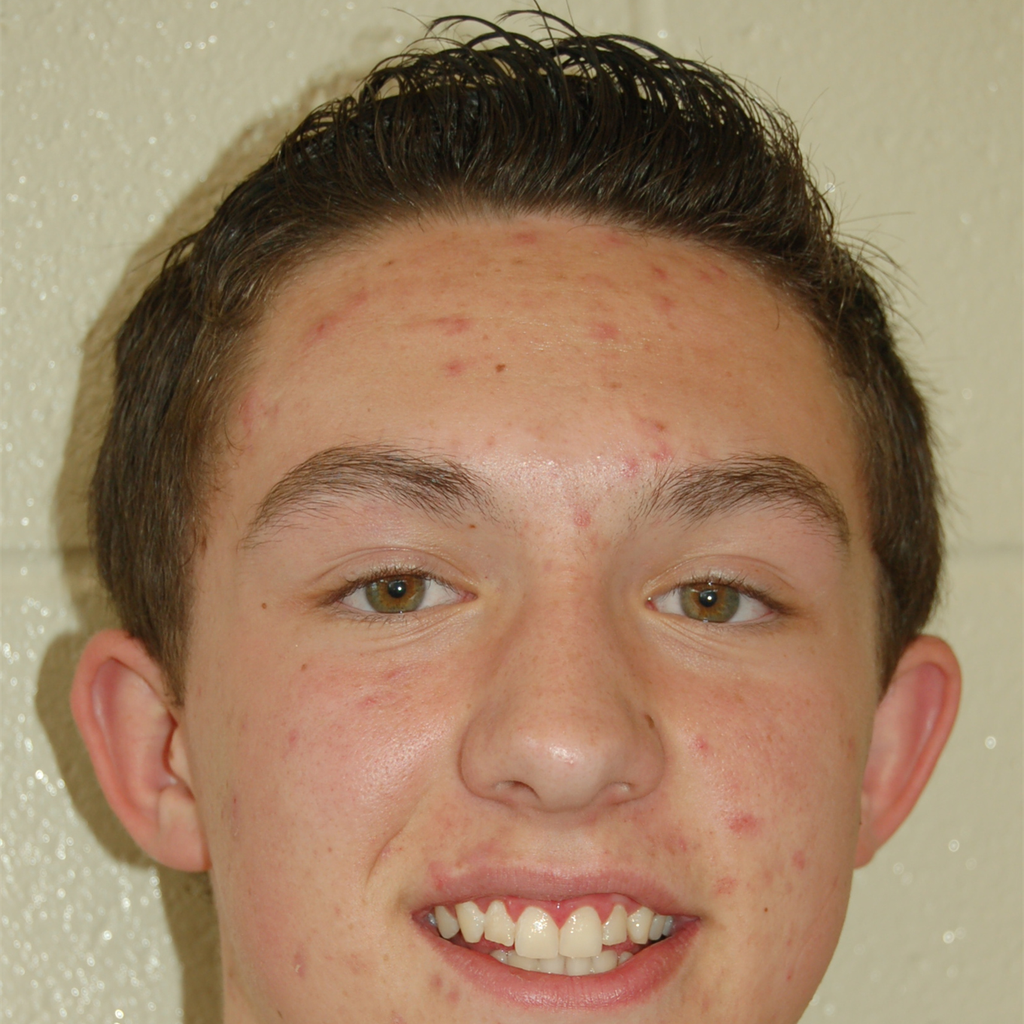 Nick Zahalka mugshot